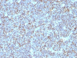 CD99 Antibody (SPM596), Novus Biologicals 0.2mg; Unlabeled:Antibodies,